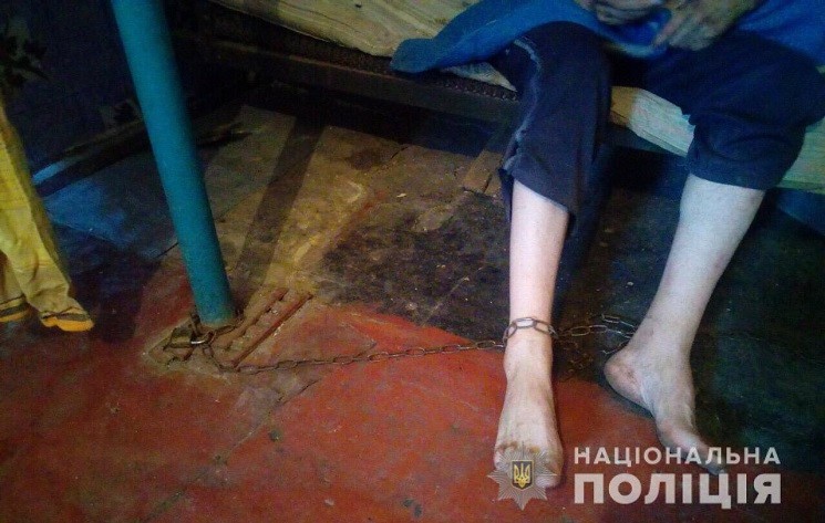 Страшно дивитися: на Дніпропетровщині матір посадила сина-інваліда на ланцюг заради грошей