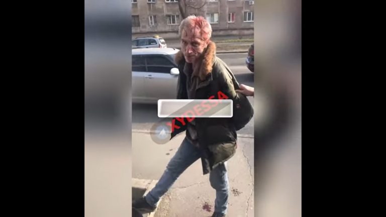 Куля потрапила в око: в Одесі неадекват посеред вулиці обстріляв сім’ю