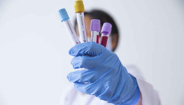 В Україні почали виробляти тести на коронавірус — секретар РНБО