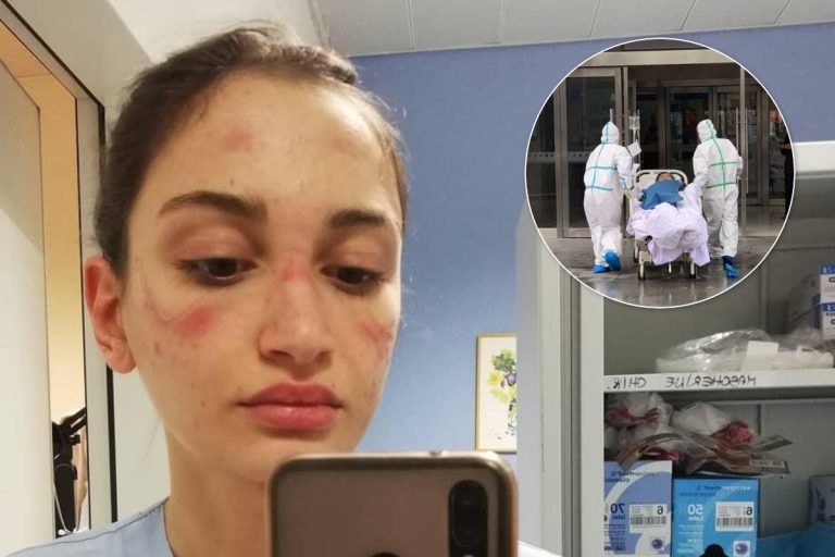 Коронавірус в Італії: медсестра показала обличчя після багатогодинної роботи в масці і надихнула мережу
