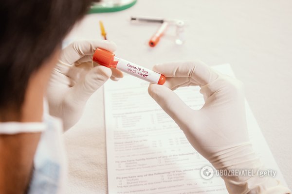 Плюс 16 за добу: кількість хворих коронавірусом в Україні зросла до 63
