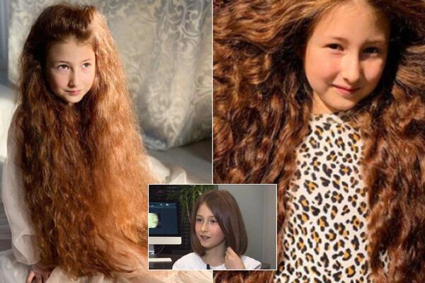 Школярка з Харкова подарувала волосся хворій дівчинці, яка страждає від булінгу