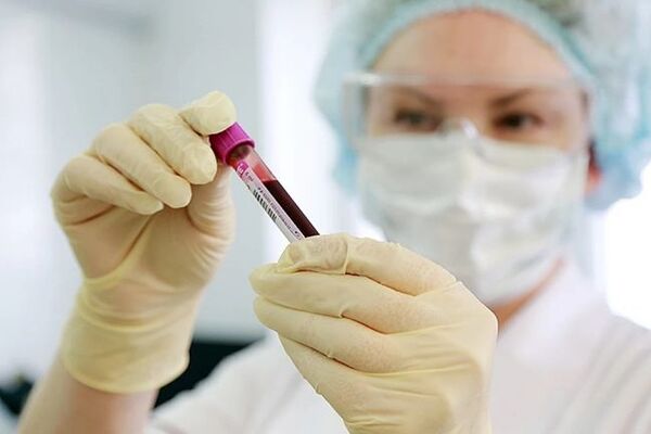 Рада ввела безкоштовне обов’язкове тестування на COVID-19: про кого мова