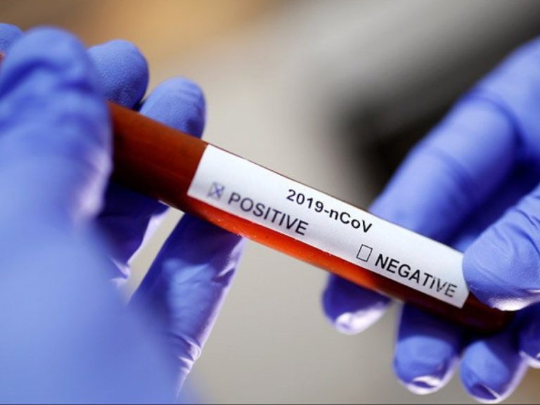 Більше 60 країн закликали розслідувати походження коронавируса