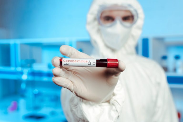 Кого в Україні тестуватимуть на виявлення антитіл до коронавірусу