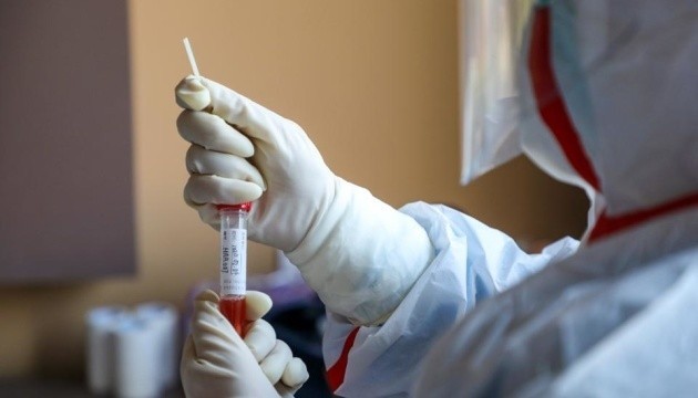 В Україні запровадили тестування на антитіла до коронавірусу