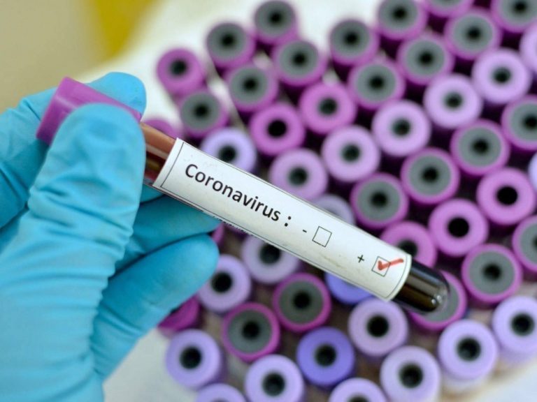 “Це добра ознака”: лікар назвав симптом, який допомагає боротися з коронавірусом