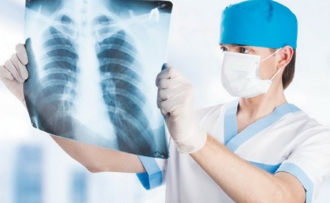 Знайшли два нових небезпечних штами туберкульозу
