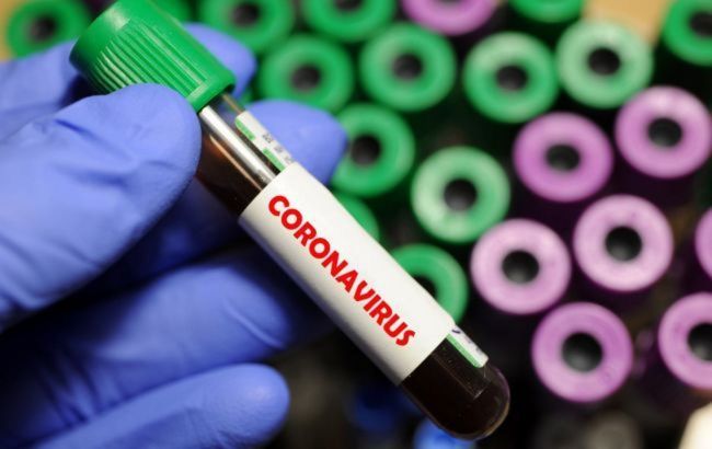 Українців почали тестувати на імунітет до COVID-19: шокуючі результати
