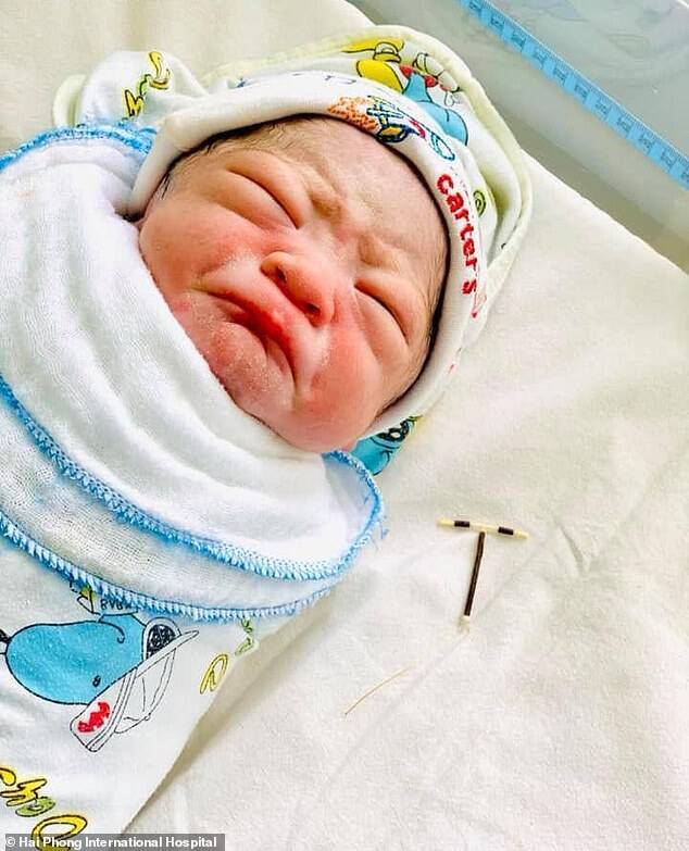 Немовля народилося з контрацептивом (фото: Hai Phond International Hospital)