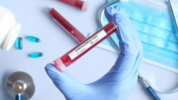 У крові людини знайшли п’ять ознак смертельної форми коронавірусу