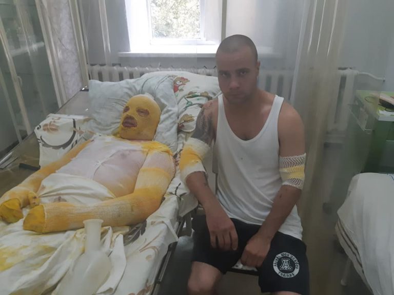 Просять допомогти бійцям які обгоріли на Луганщині, один з них сирота