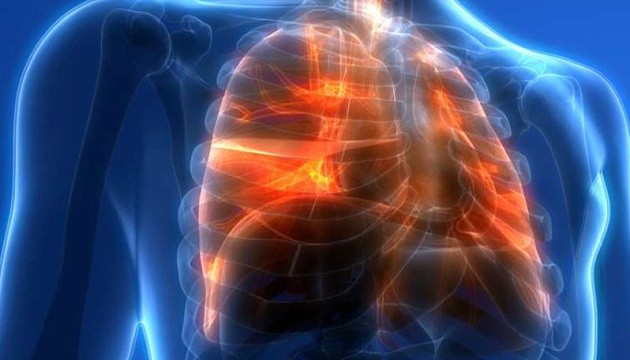 Медики розповіли, чи відновлюються легені у людей, які хворі на COVID-19