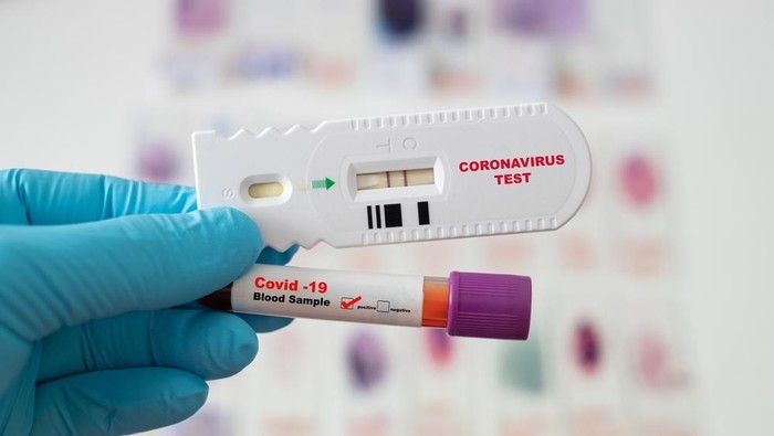 У “Слузі народу” пояснили, чому українців не тестують на коронавірус безкоштовно