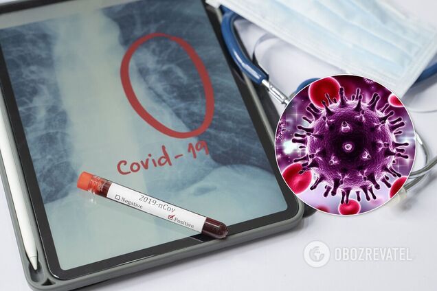Учені знайшли ліки, які можуть знизити тяжкість коронавірусу