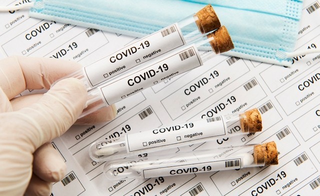 В Україні змінять ПЛР-тести через новий штам коронавірусу