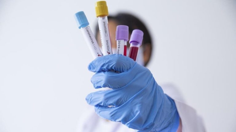 Комаровський розповів, як “брешуть” тести на коронавірус і чи потрібні вони взагалі