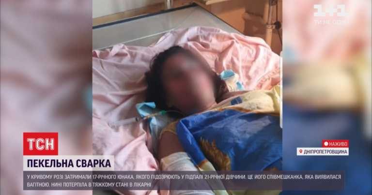 У Дніпропетровській області рятують вагітну дівчину, яку підпалив її хлопець