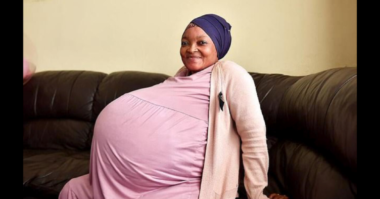 Жінка, “яка народила 10 дітей за раз”, навіть не була вагітною