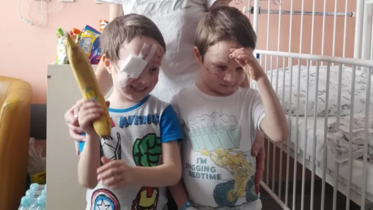 Українська родина, яка втратила зір від поранень осколками, зможе бачити