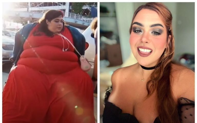 Дівчина шокувала схудненням на 180 кіло: фото до і після