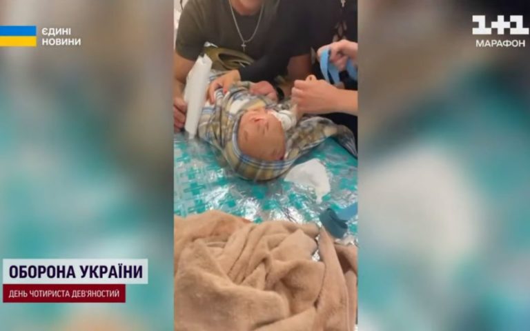 Відео з нею облетіло світ: найменшу постраждалу від удару в Краматорську дівчинку виписали з лікарні…