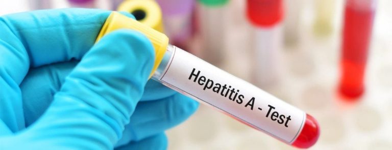 В Україні зростає захворюваність на гепатит A: медики дали поради, як не наражати себе на небезпеку