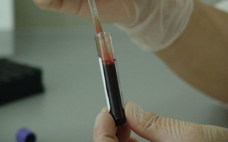 Спалах гепатиту зафіксований в іще одному регіоні України